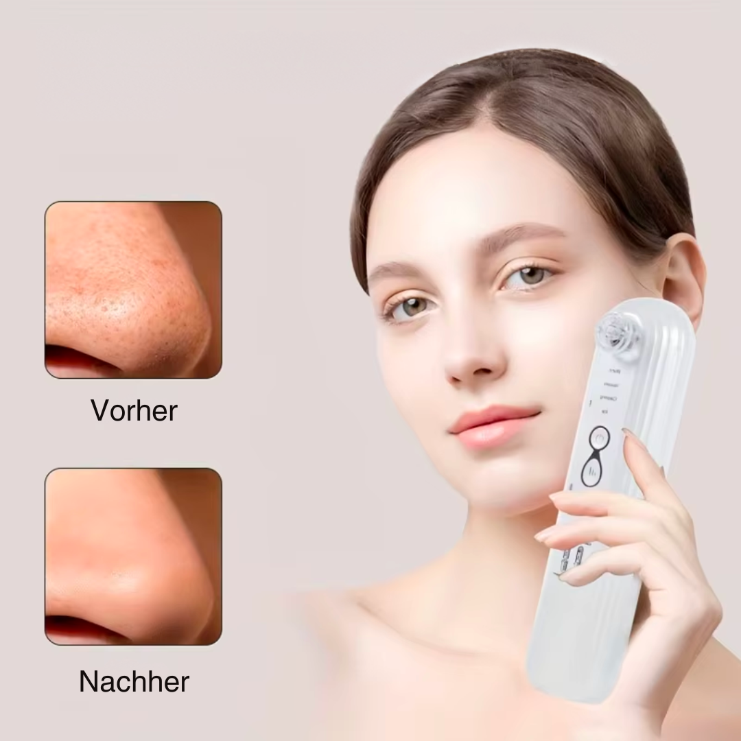 Spotless Skin